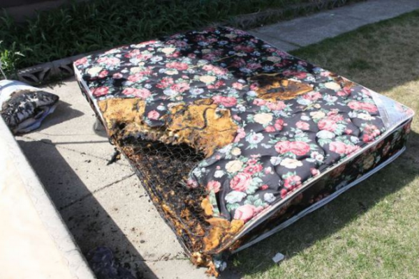 Apple-iPhone-catches-fire-burns-teenager (5)